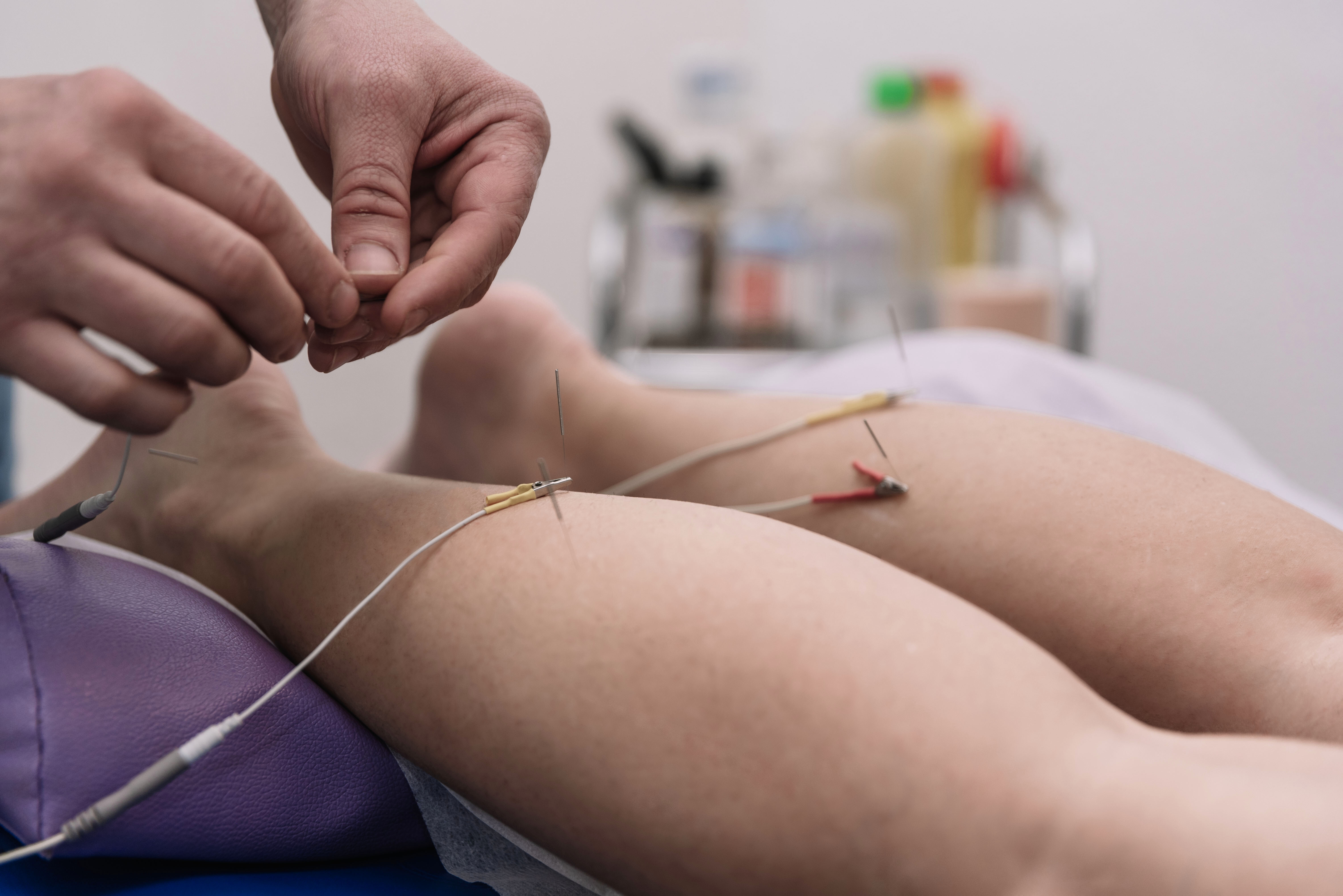 Dry Needling